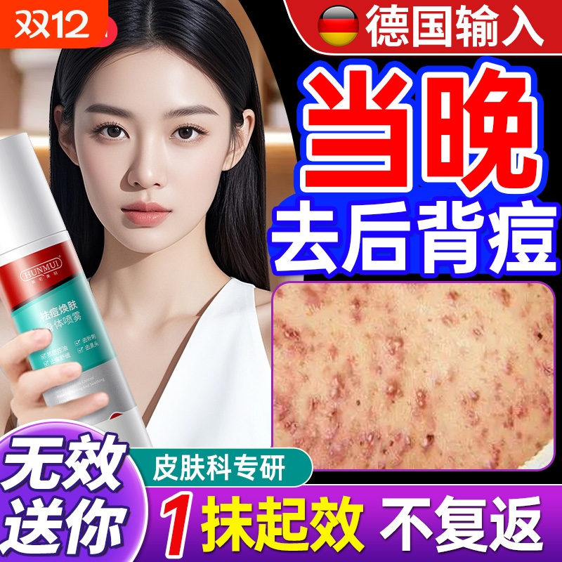 韩伦美羽祛痘喷雾|262人收藏