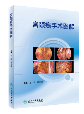 宫颈癌手术图解人卫宫腔镜