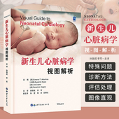 心脏胚胎学与胚胎病 诊断方法 视图解析 译 胎儿心脏病 等 新生儿心脏病学 孙国成 心脏病流行病学 正版 自然史及非自然病史 书籍