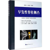 先天性脊柱侧凸和椎体分节障碍 影响 遗传学 综合征型脊柱侧凸 神经并发症指南 早发性脊柱侧凸 围术期 脊柱发育异常对呼吸功能
