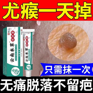 云南本草克疣膏去疣药水尤脖瘊子小肉粒扁平疣去除软膏一抹灵神器