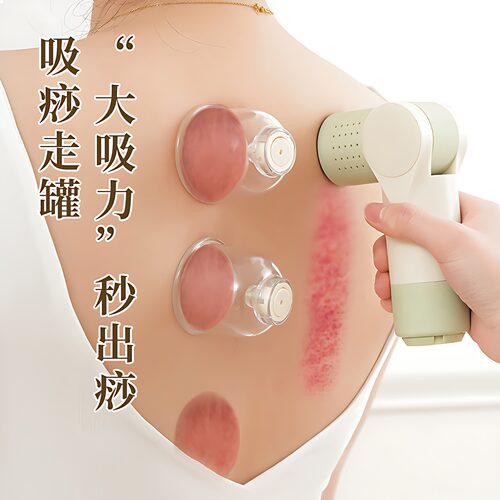 砭石艾灸按摩罐按摩仪刮痧拔罐仪