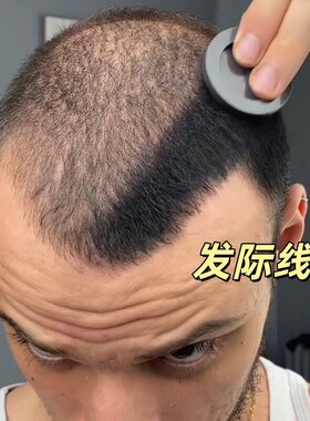 发际线遮盖粉防水防汗不伤头皮发缝填充神器化妆师发际线粉遮白发
