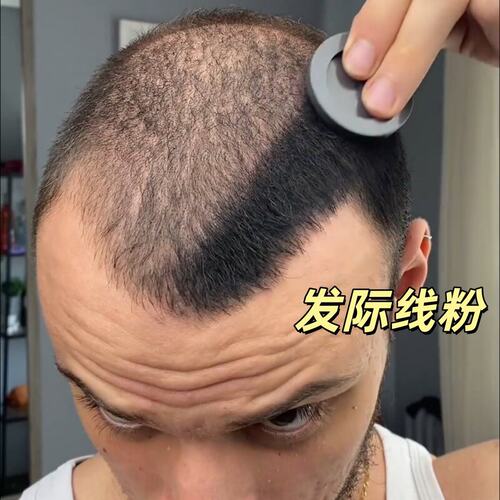 发际线遮盖粉防水防汗不伤头皮发缝填充神器化妆师发际线粉遮白发