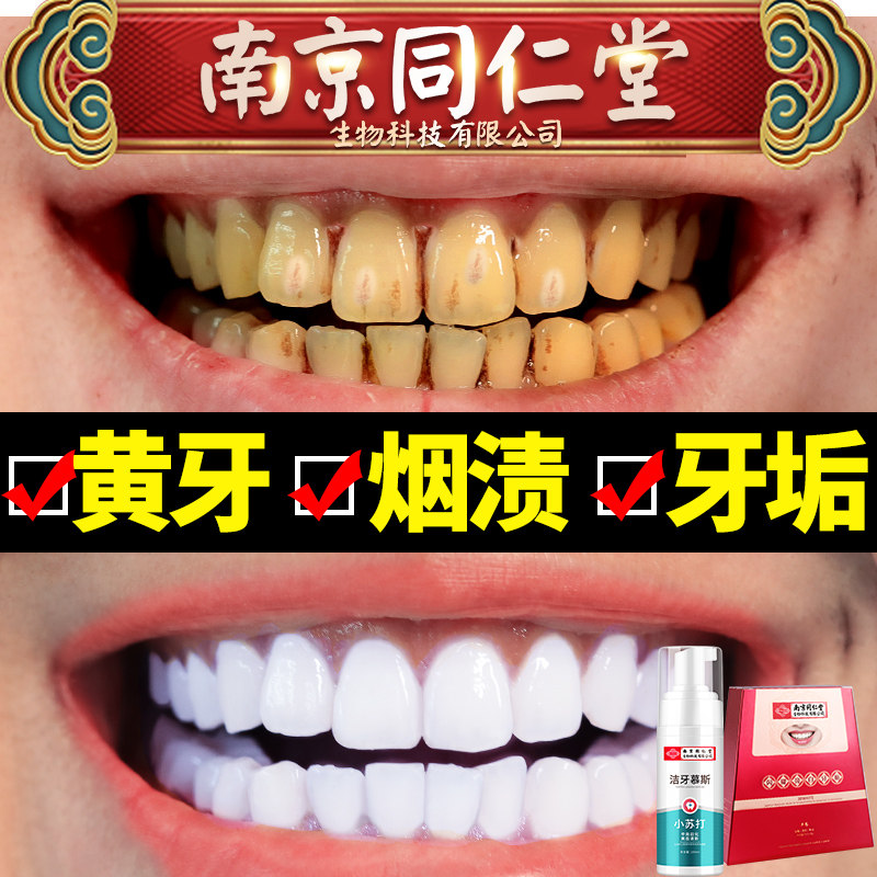 薇娅牙贴面亮白美白牙齿美牙贴去黄贴片白牙白神器洁白速效李佳琦