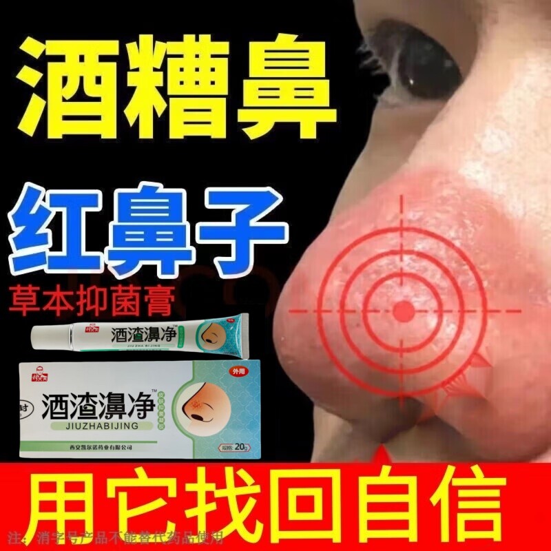 正品穆大夫酒渣鼻净酒糟鼻红鼻子玫瑰糠草莓鼻疹粉刺黑头鼻头肿大