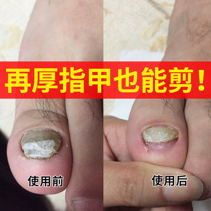 指甲刀日本老人灰厚专用剪脚趾甲钳大指甲剪指甲钳指脚刀修脚工具
