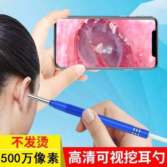 可视采耳仪器可是耳镜掏耳勺掏耳朵手机内窥镜探头儿童耳道内视镜