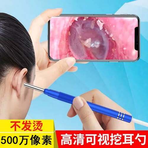 可视采耳仪器可是耳镜掏耳勺掏耳