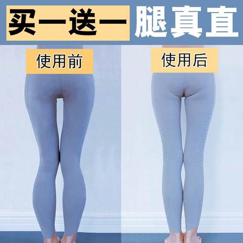 O型X型小腿外翻足内翻足弓塌陷改善弯腿