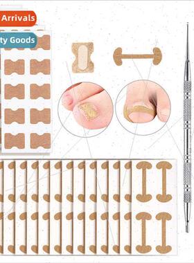 Ortho Nail Patch Corrector Nail Groove Ingrown Nail Stching