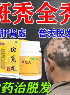 斑秃丸鬼剃头药斑秃效药增发掉头发治疗毛片脱落乌发防脱特发丸ZM