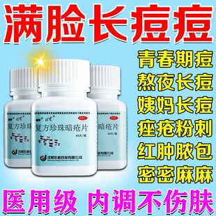 复方珍珠暗疮片祛痘玫瑰痤疮药清热解毒片内服去痘痘闭口粉刺ZM