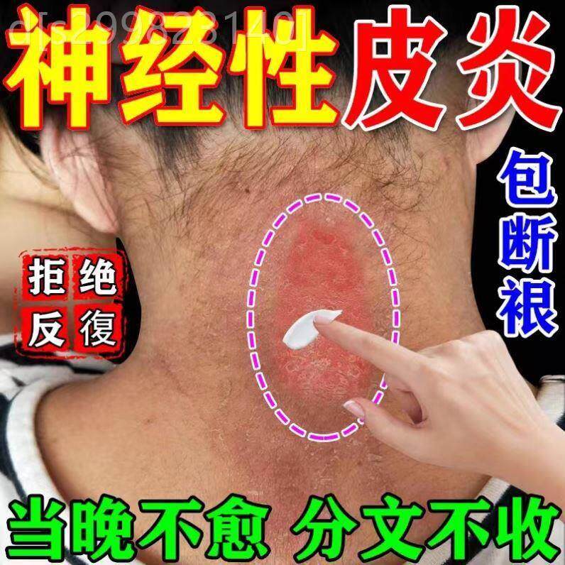 专用泡脚藓手气小水泡治神经性皮炎儿童脚底湿疹手脱皮硫磺药膏癣