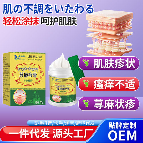 蕁麻外用保健膏 皮膚瘙癢紅點疙瘩劃痕塗抹膏緩解過敏蕁麻雞皮膏