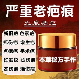 祛疤膏疤痕增生凸起去除疙瘩瘢痕剖腹产修复去疤痕修复凝胶软化针