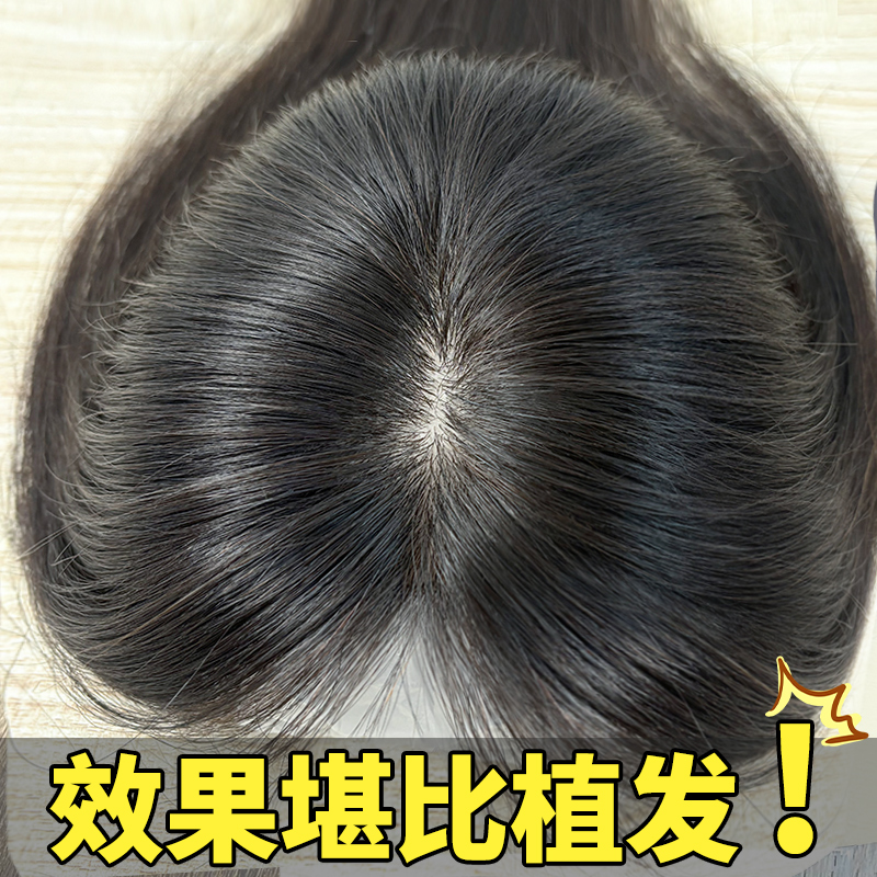 天空树【颖儿推荐】双递针补发片