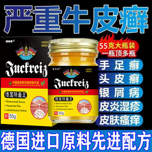 牛皮藓银股药手足头藓疹皮湿炎止痒皮肤专用膏屑