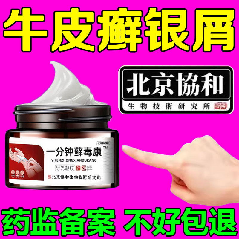牛皮癣银屑病药膏真菌感染皮肤瘙痒湿疹手足头皮体股藓用专止痒膏