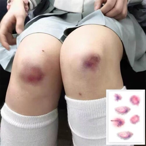 淤青仿真贴伤病态美学伤疤纹身贴