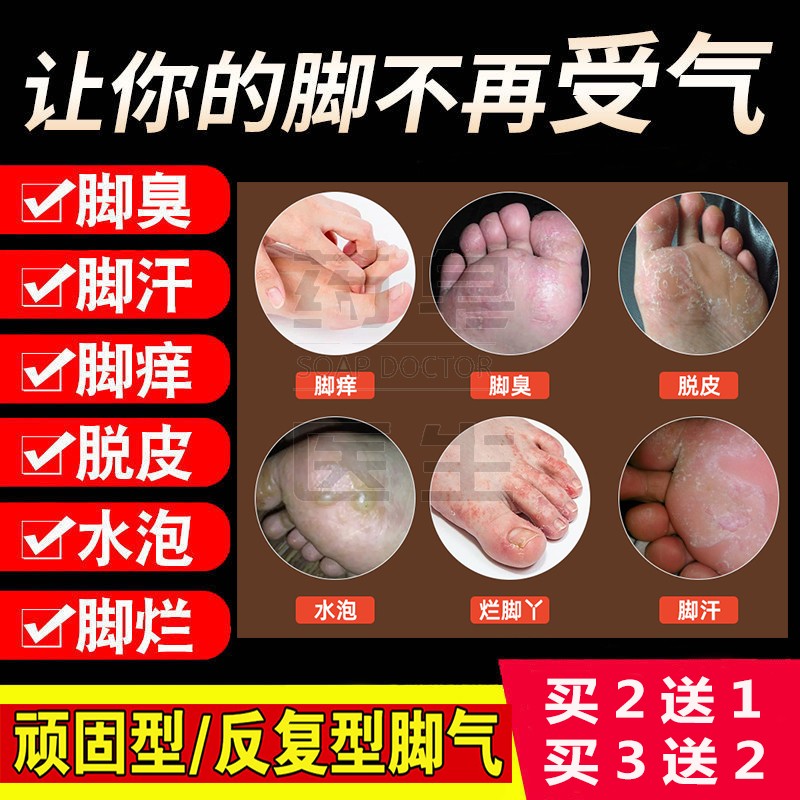 洗脚皂泡脚去脚气止痒香港脚烂脚丫脚气克星洗脚除臭止痒足部香皂