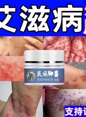 治艾滋病外用药病毒感染疱疮丘疹瘙痒止痒急性黏膜湿疣皮藓乳膏