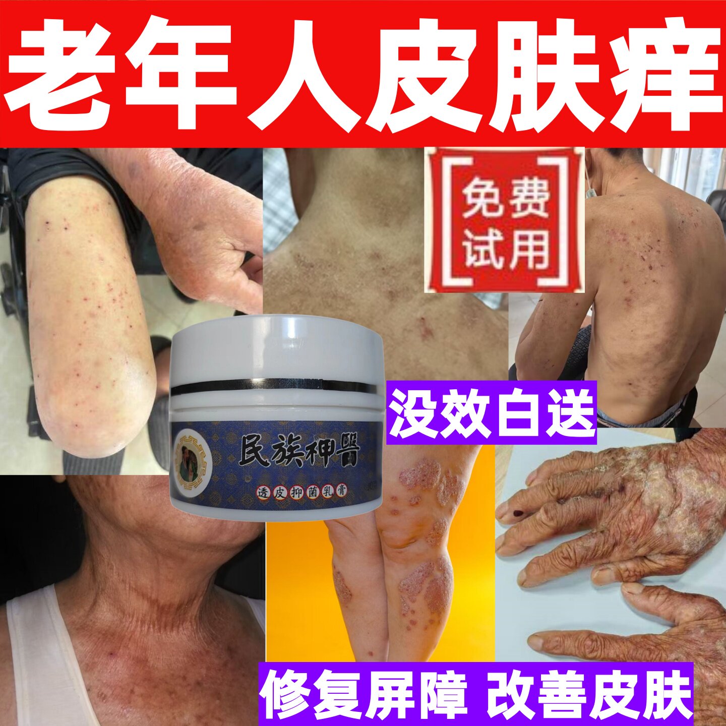 老年性人皮肤干燥瘙痒全身痒脱屑冬夏天干燥止痒抑菌外用身体乳膏