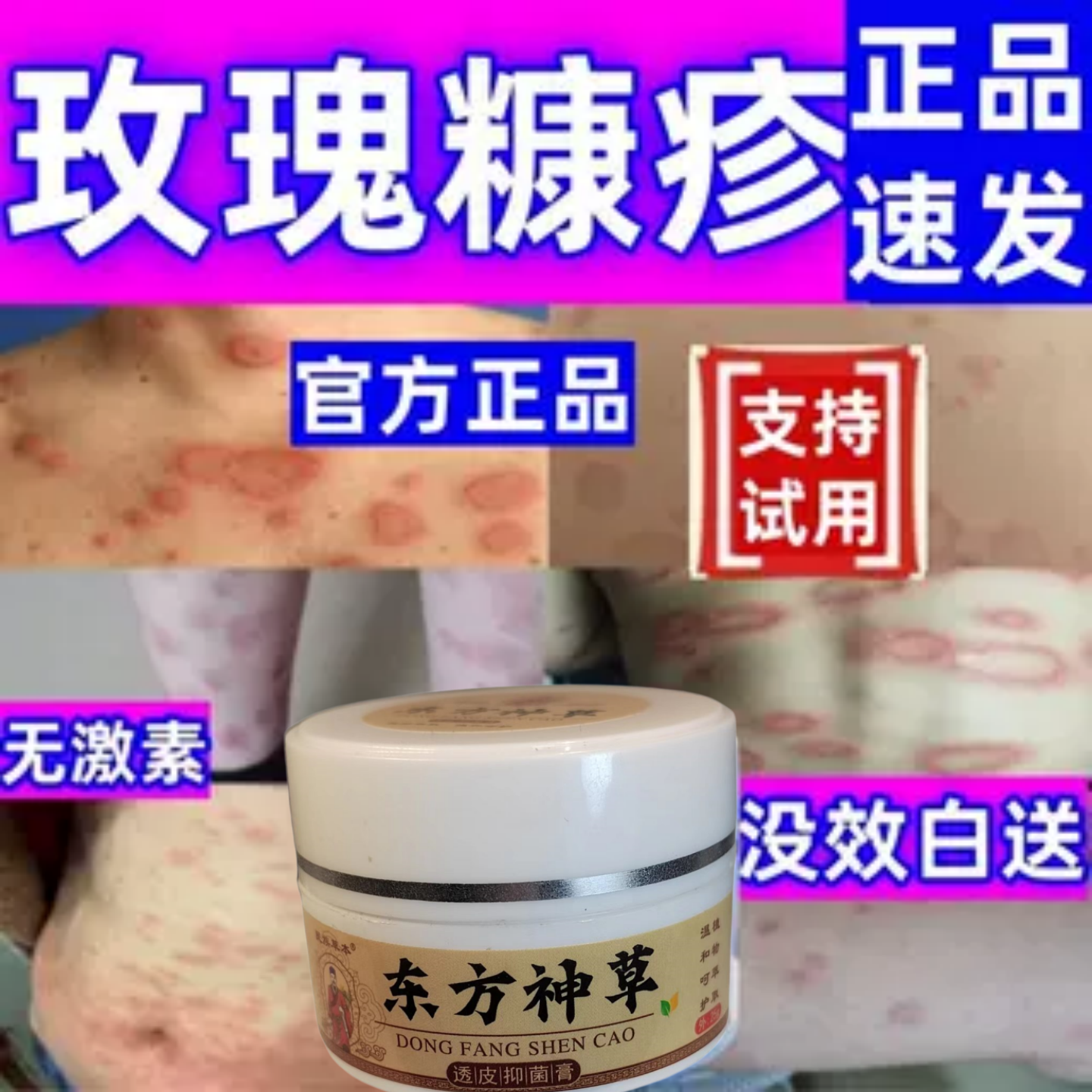 玫瑰糠疹特效修复膏皮肤红斑鳞屑花斑皮疹涂抹膏