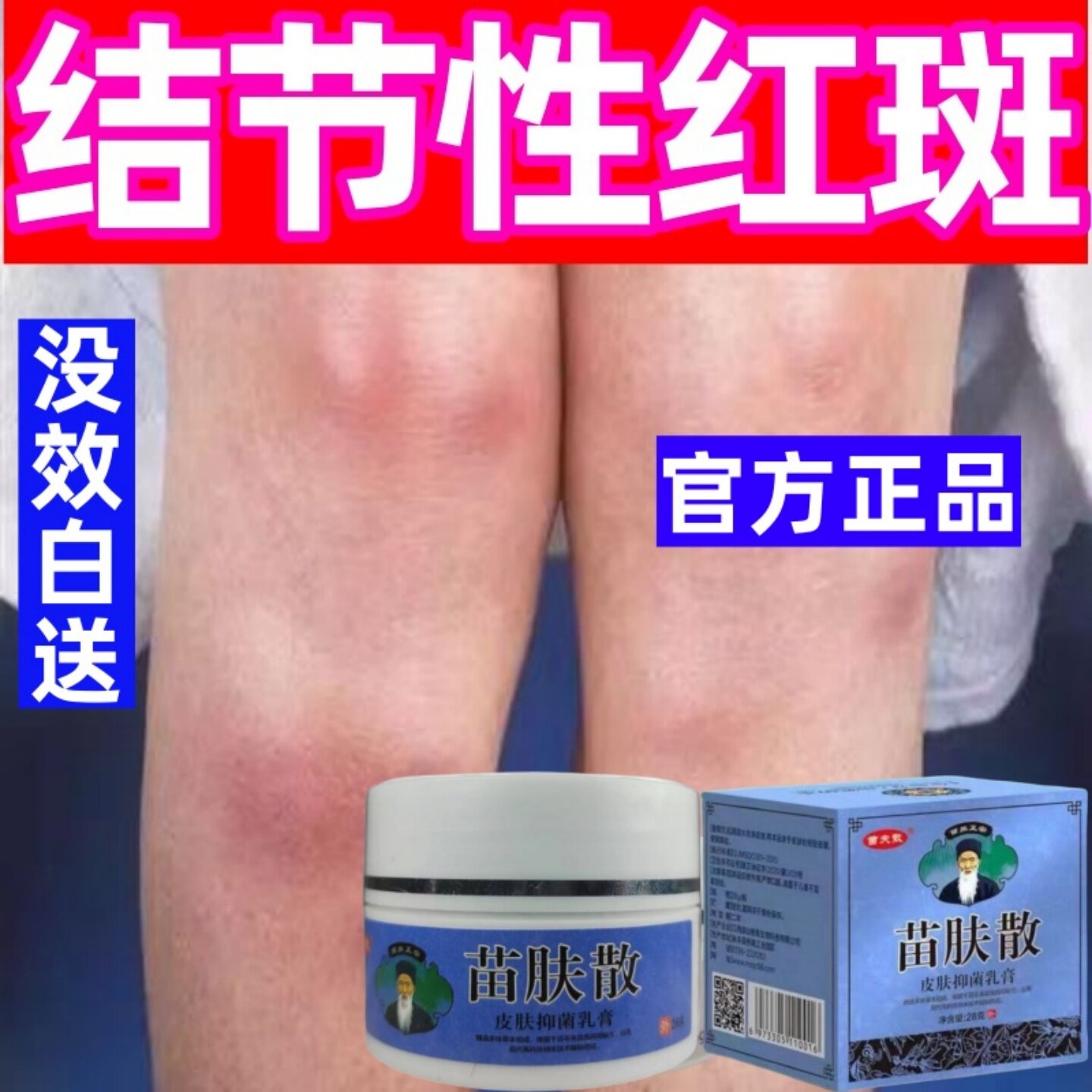 结节性红点红斑小腿下肢皮下硬块疙瘩红肿疼灼烧鼓包外用膏