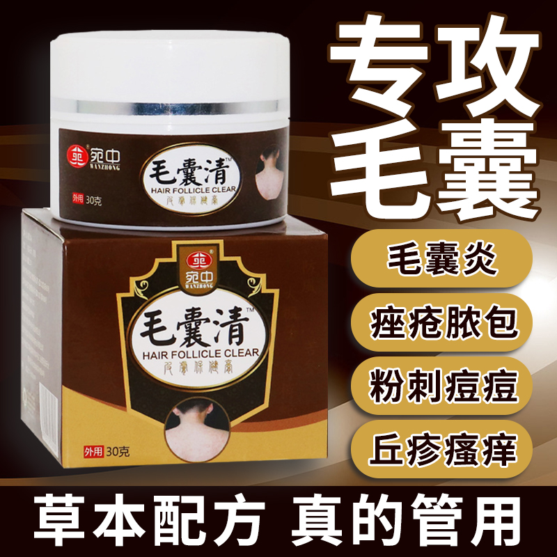 漳州复方片仔癀软膏毛囊乳膏药膏痤疮毛囊炎带状疱疹脓疱疮外用药