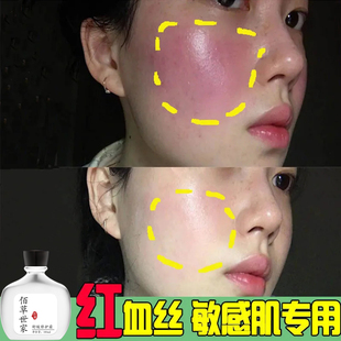 佰草世家去红血丝修复敏感肌增厚肌肤角质层强效保湿补水精华液
