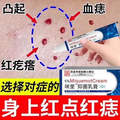 身上红点血管瘤红痣专用膏