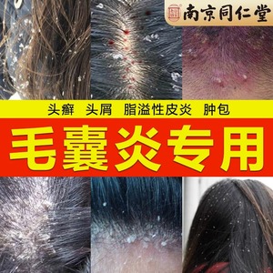 氨基酸洗发水防脱生发中药洗发水防脱生发增发密发洗头膏去屑止痒