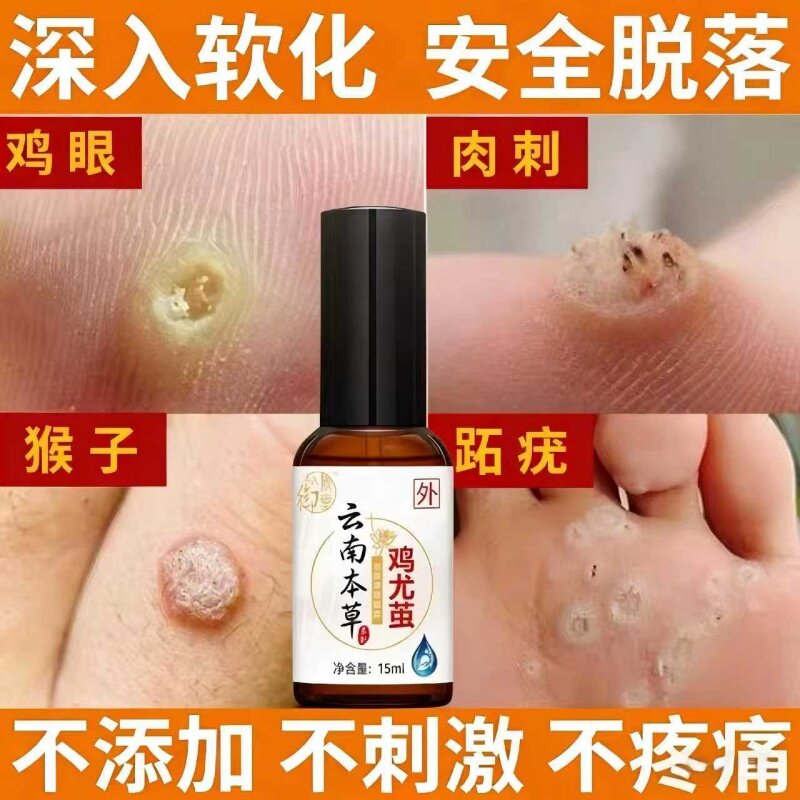 鸡眼贴鸡眼抑菌液去脚底脚趾部一抹灵除跖疣老茧根肉刺官方旗舰店