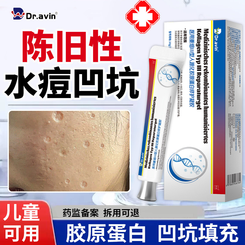 凹陷性水痘疤痕修复去水痘坑填充生长因子痘坑凹洞儿童祛疤膏QQ
