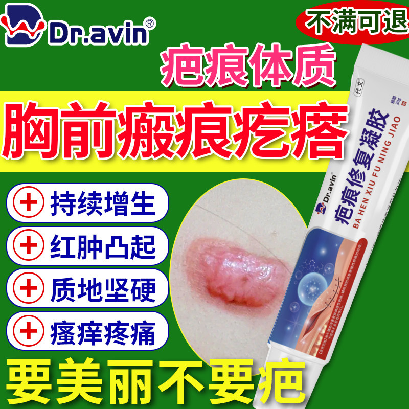 增生疤痕凸起硬肉疙瘩胸前瘢痕修除疤膏止贴痒软化针去SE