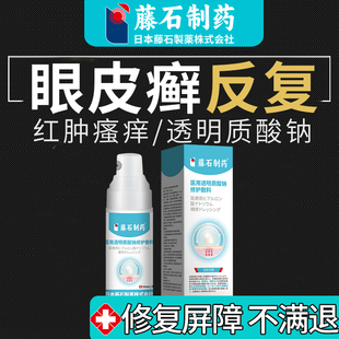 眼皮癣眼皮红肿痒眼睛周围过敏发痒神经性皮炎起皮眼角干燥掉屑SE