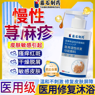 过敏性慢性胆碱性寻荨麻疹过敏止痒根提高免疫力止痒膏非沐浴露CS