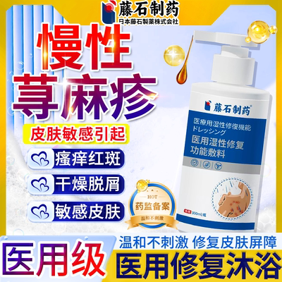 过敏性慢性胆碱性寻荨麻疹过敏止痒根提高免疫力止痒膏非沐浴露CS