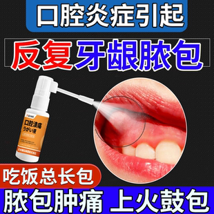 儿童可搭上火牙龈脓包肿包专牙根尖囊肿发肿痛炎消药监备案用CS