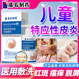 藤石湿性敷料儿童特异性特应性皮炎身体乳湿疹保湿霜止痒去专用CS
