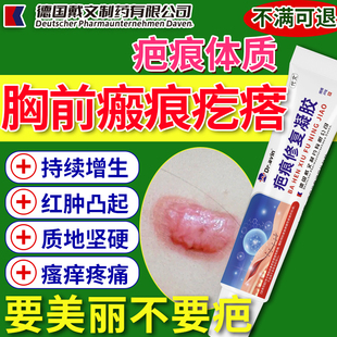 增生疤痕凸起硬肉疙瘩胸前瘢痕修除疤膏止贴痒软化针去SE