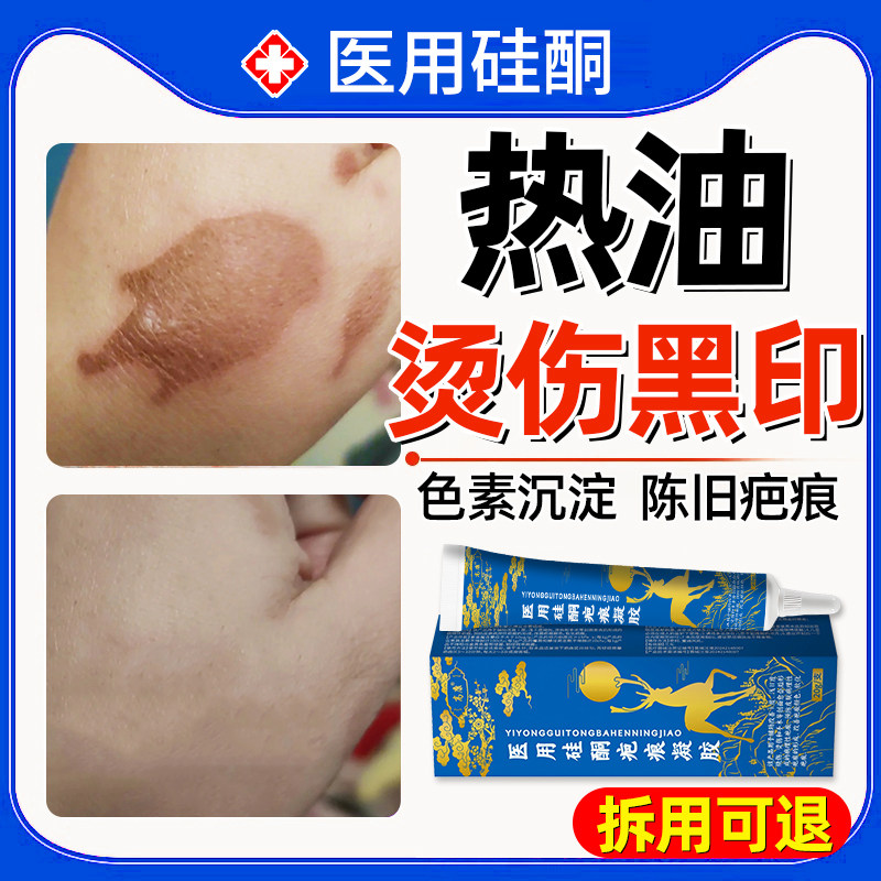 热油烫伤疤痕修复除疤膏去黑印黑色素沉淀祛疤膏淡化去除去疤膏QQ