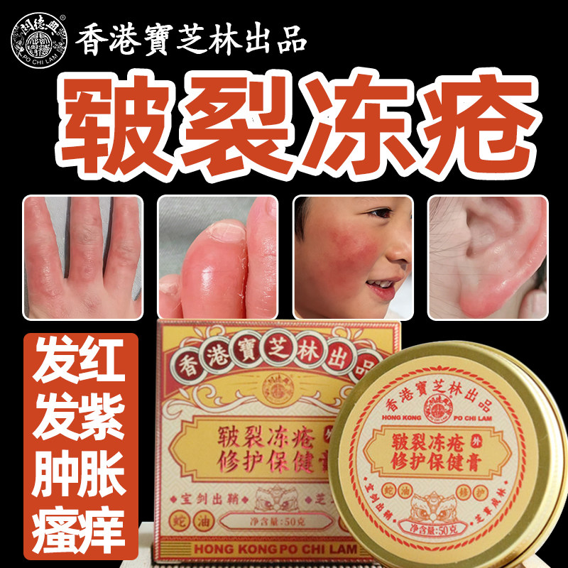 手脚耳朵脸冻伤干裂冻疮防冻伤膏