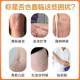 Сибангские вены, охлажденные компрессы, гелевые зеленые сухожилия, поднятые боль в ногах, болезненность, отек эритроцитов