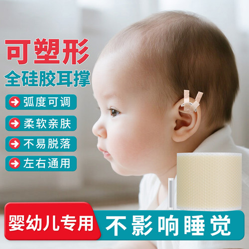 婴儿耳朵矫正器新生儿耳廓矫形