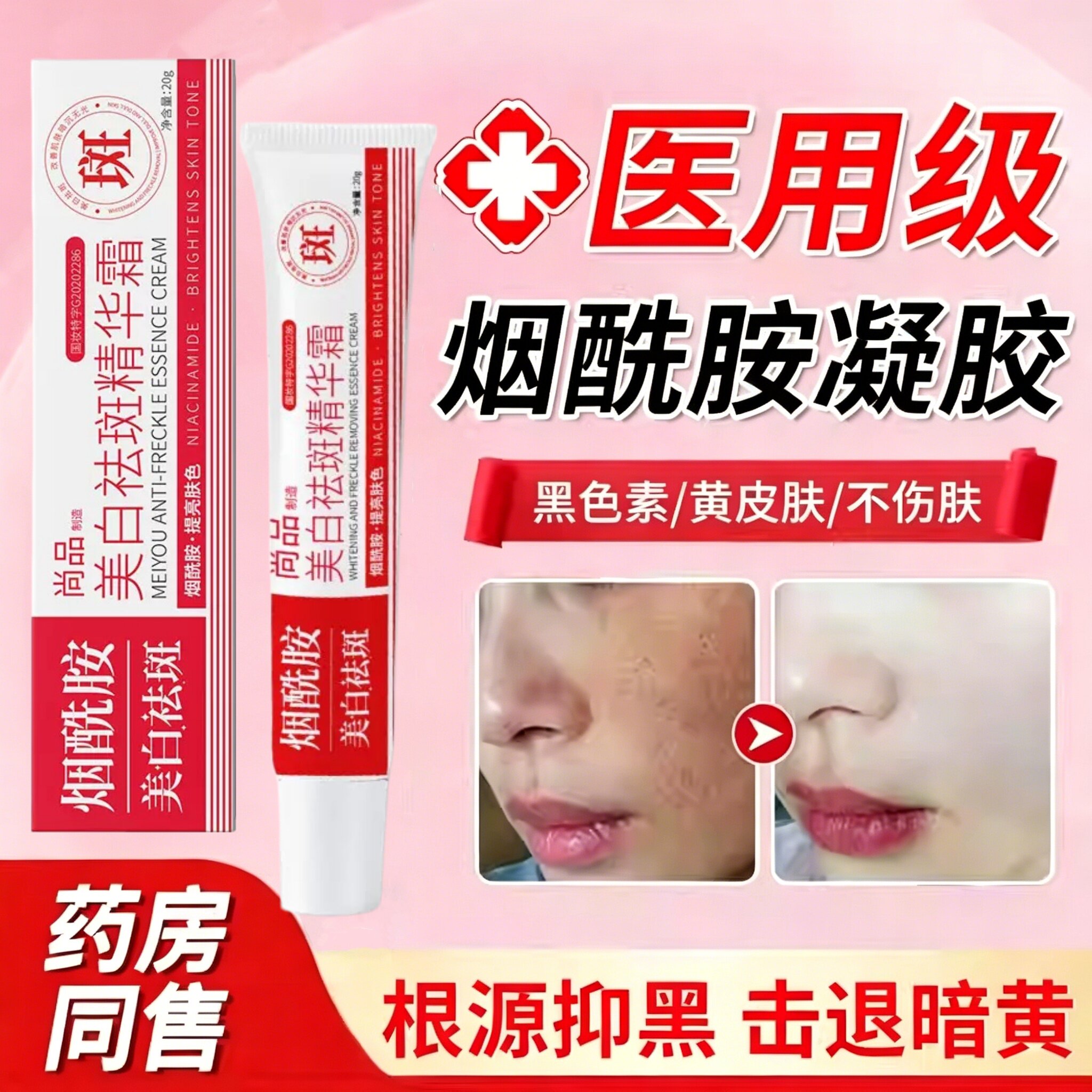 【3天告别黄·黑】烟酰胺凝胶图片