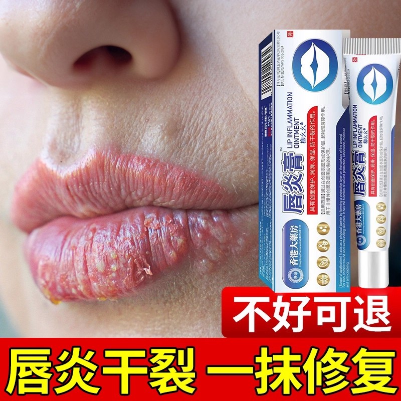 唇炎唇膏修复嘴唇红痒干裂干燥脱皮起皮起水泡嘴角口角开裂正品