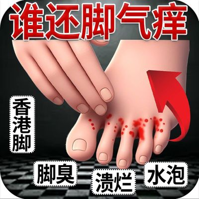 脚气止痒除脱皮去杀菌真菌感染喷雾剂脚痒臭膏泡脚出汗专用烂脚丫