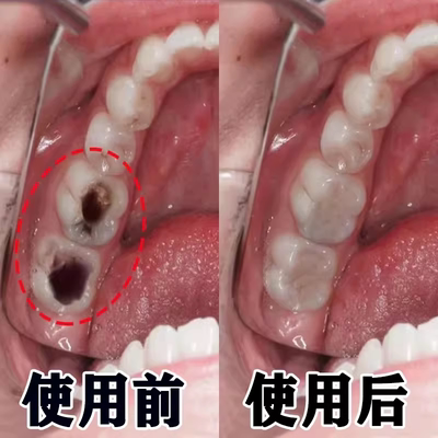 【日本专研】再生硅防蛀修复牙膏